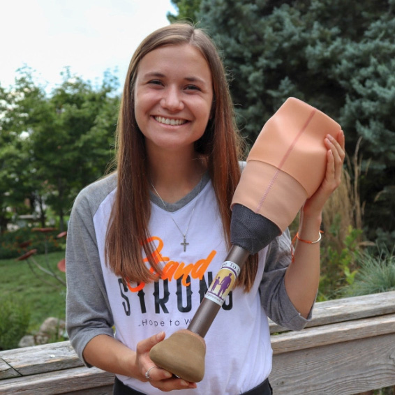 image of a girl holding a prosthetic leg